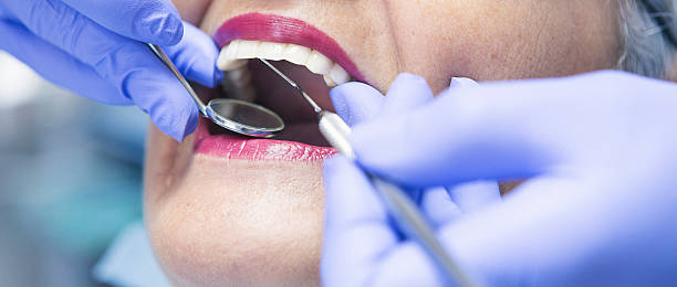 Best Emergency Dentist for Lost Fillings or Crowns in Terre Du Lac, MO